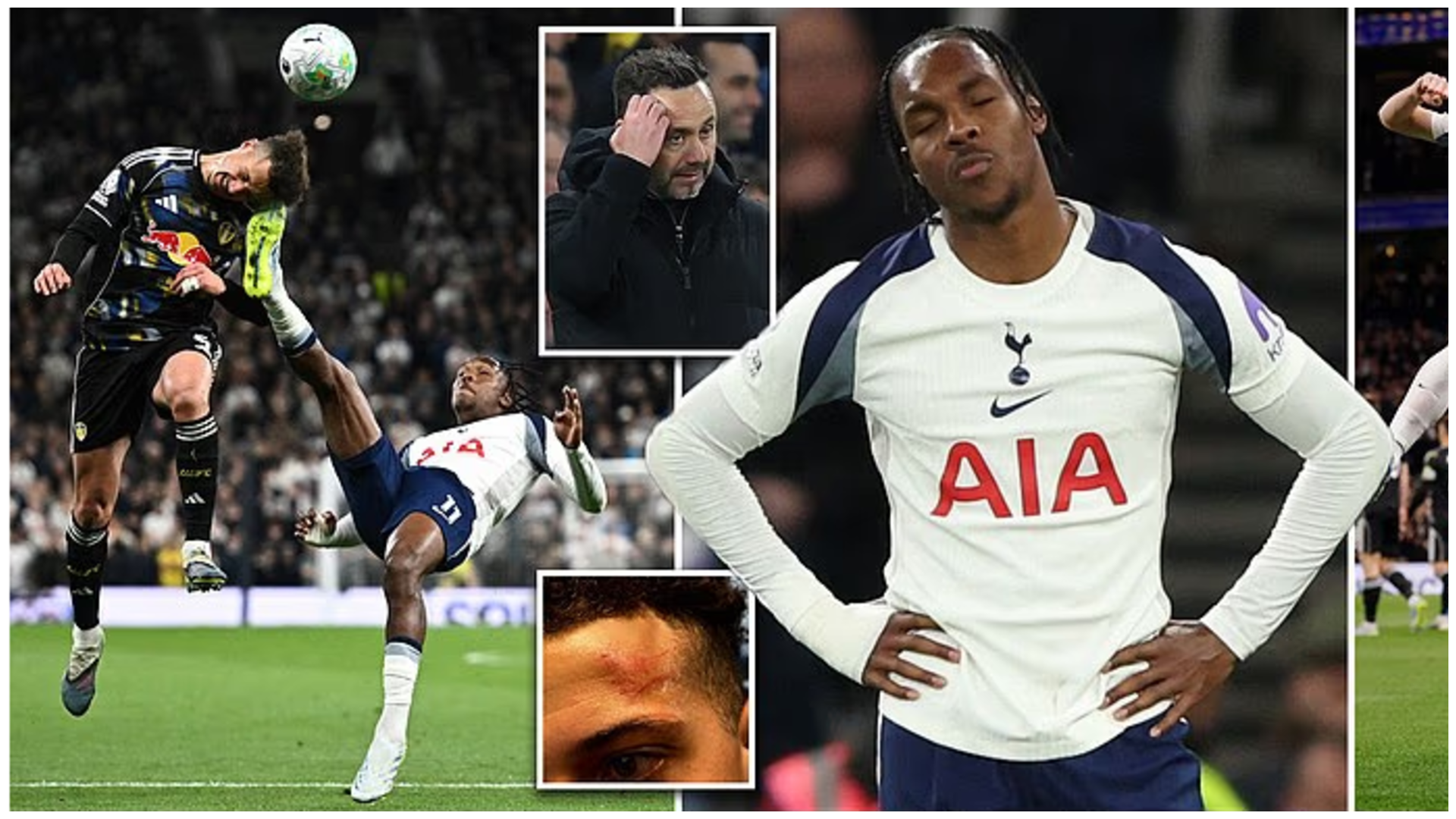 SPURS Pict
