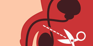 vasectomy