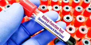 KidneyTest2