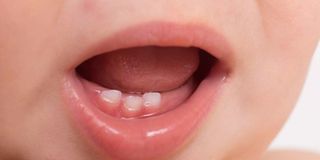 Baby teeth